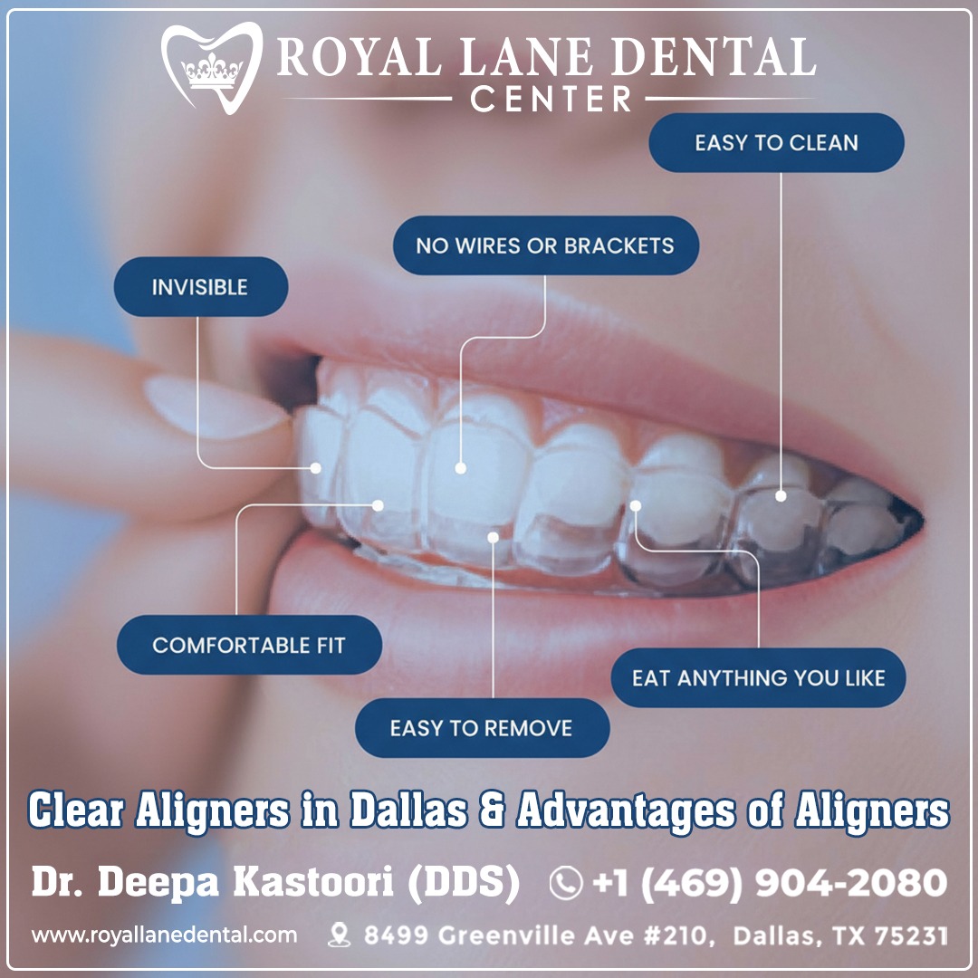 Clear Aligners in Dallas